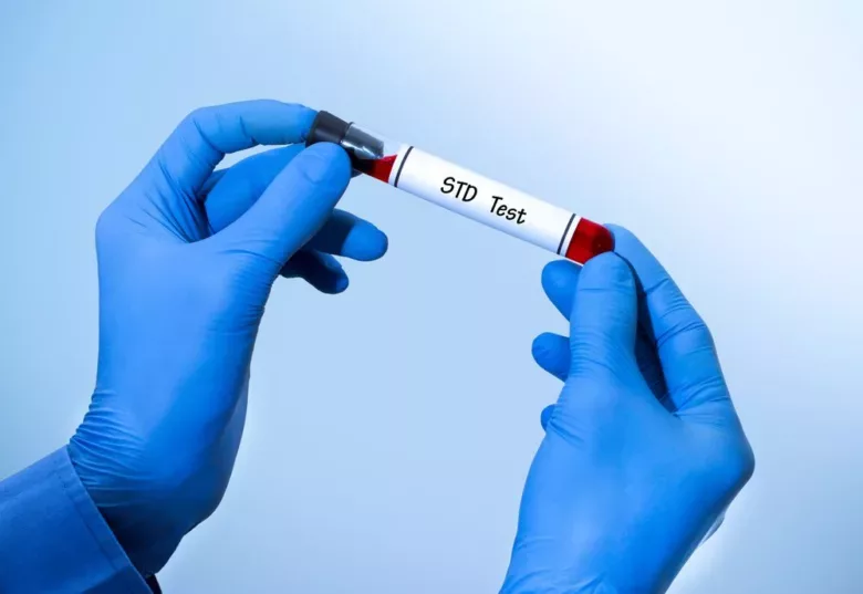Rapid gonorrhea stis & stds testing