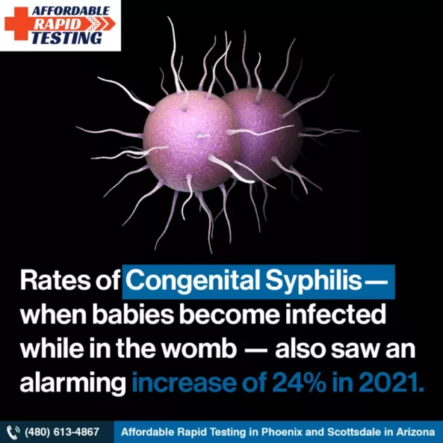 Syphilis std testing near phoenix scottsdale az