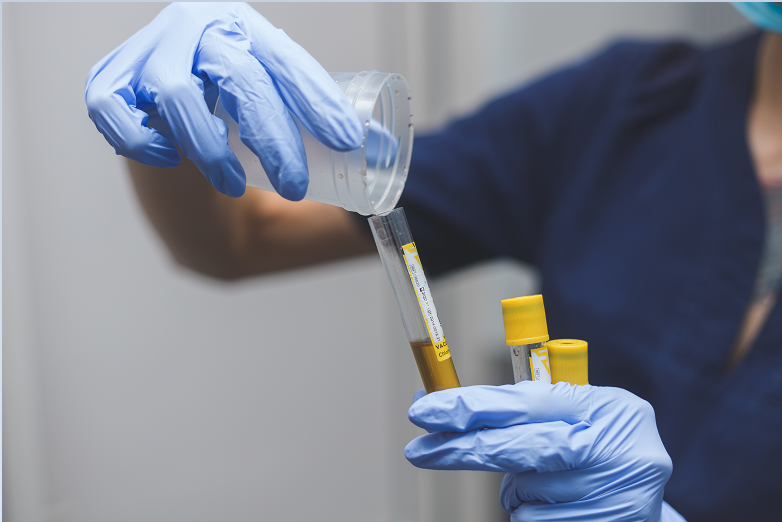 Urine drug test affordable rapid testing phoenix scottsdale az