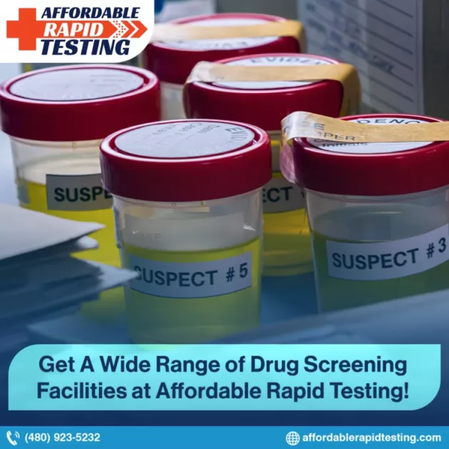 Drug screening test affordable rapid testing
